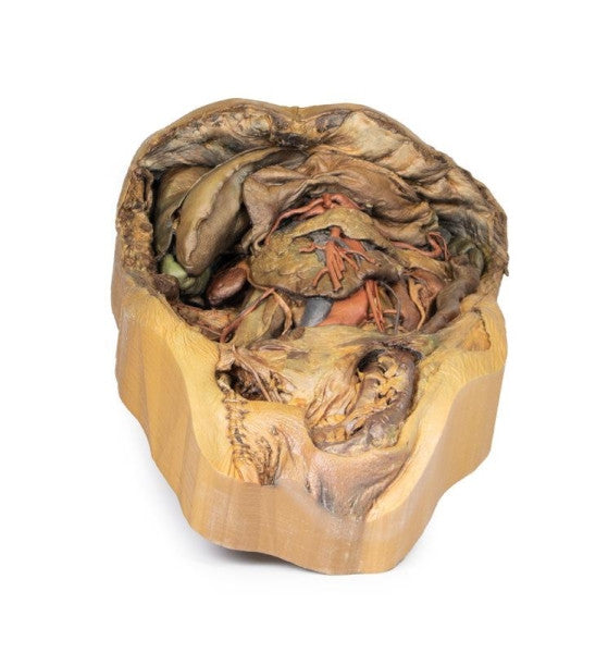 Abdomen 3D Printed Anatomy Model