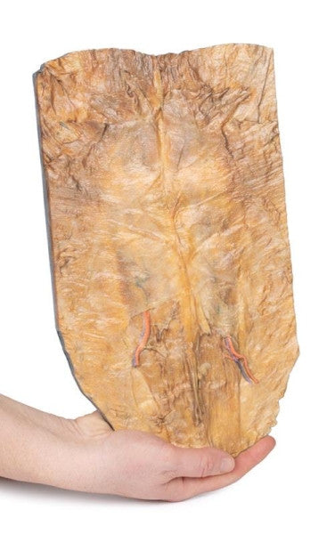 Frontal View of the Internal Abdominal Wall Model