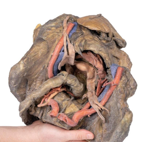 Female Pelvis 3D Printed Anatomy Model