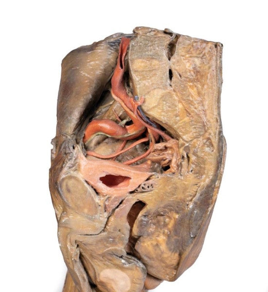 Male Pelvis 3D Printed Anatomy Model