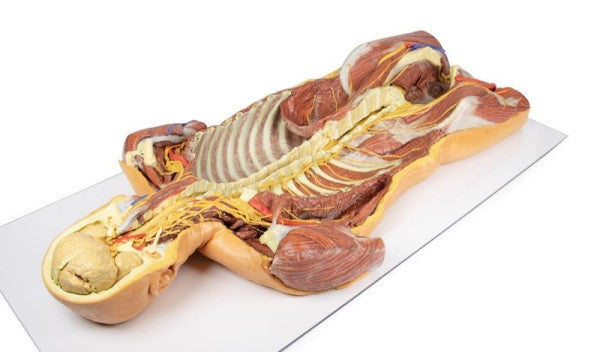 Body Wall 3D Printed Anatomy Model