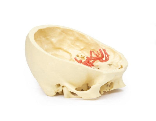 Brain Circulation 3D Printed Anatomy Model