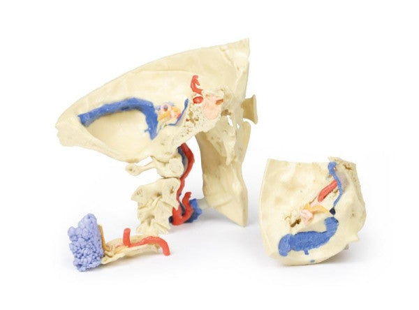 Skull 3D Printed Anatomy Model