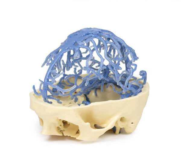 Brain Circulation 3D Printed Anatomy Model