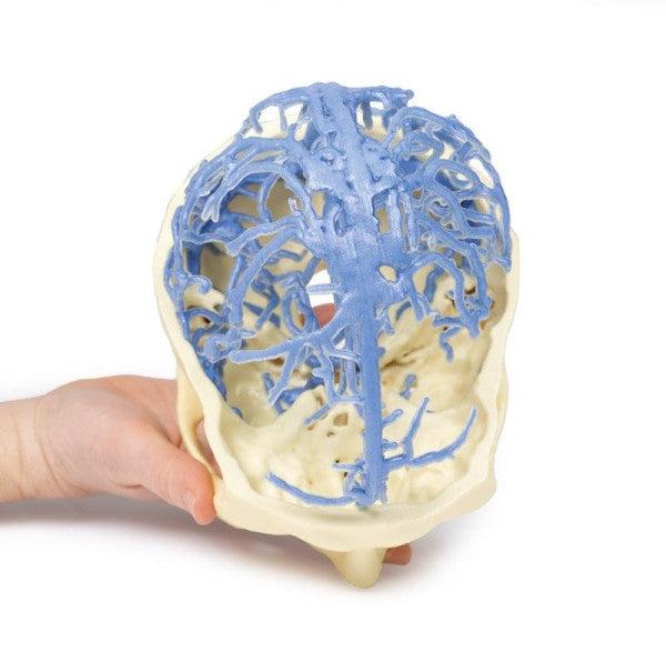 Brain Circulation 3D Printed Anatomy Model