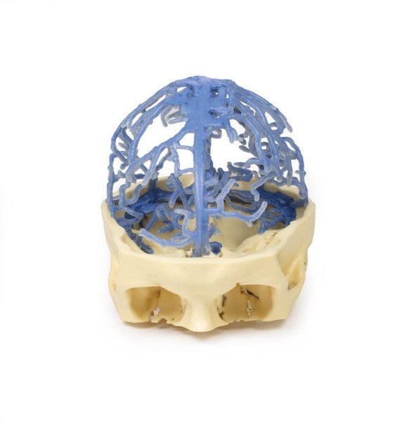 Brain Circulation 3D Printed Anatomy Model