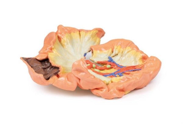 Bowel 3D Printed Anatomy Model