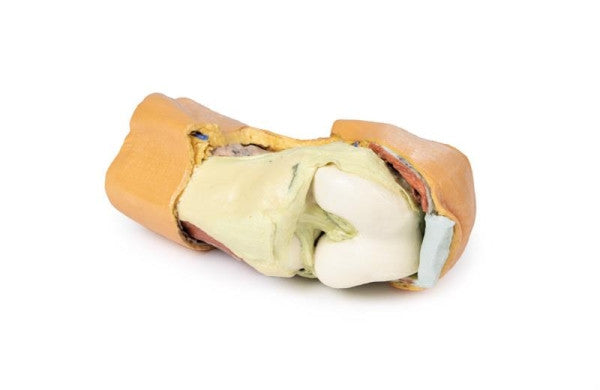Flexed Knee Joint Deep Dissection Model