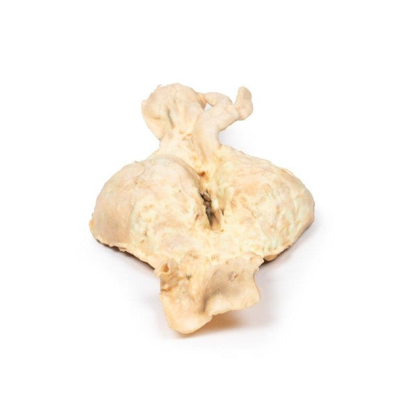 Posterior Aspect of the Abdominal Aortic Aneurysm Model