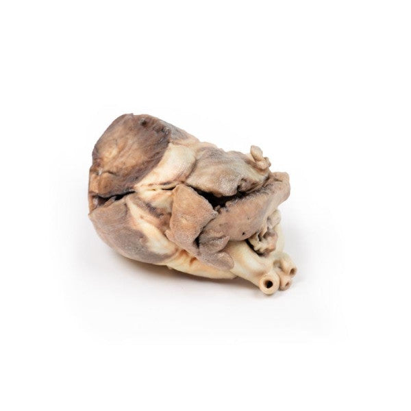 Valvular Disease 3D Printed Anatomy Model