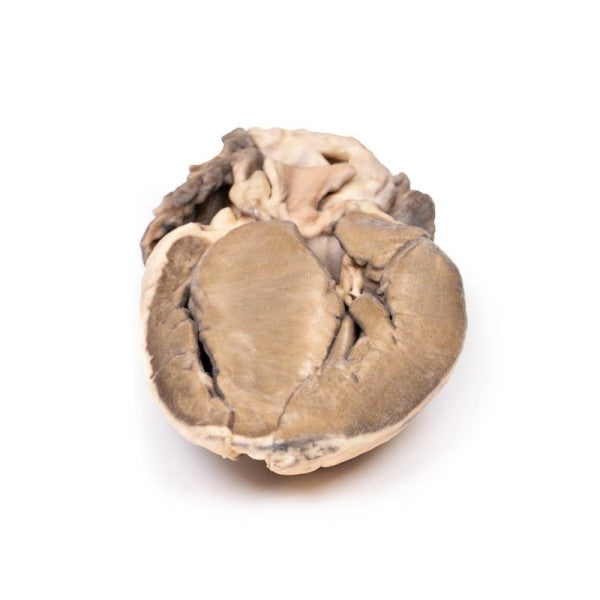 Hypertrophic Subaortic Stenosis 3D Printed Anatomy Model