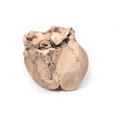 Switch Posterior Aspect of the Acute Bacterial Endocarditis Model 2 image