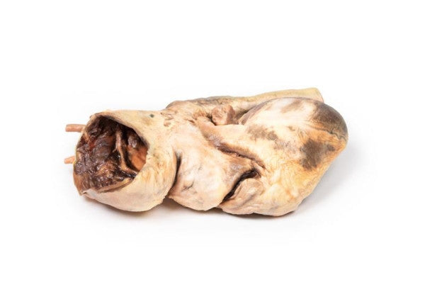 Inferior Aspect of the Syphilitic Aneurysm Model