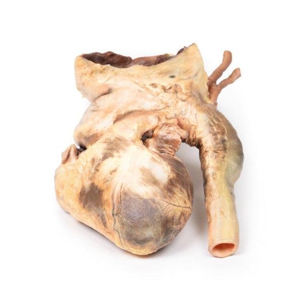 Aneurysm 3D Printed Anatomy Model