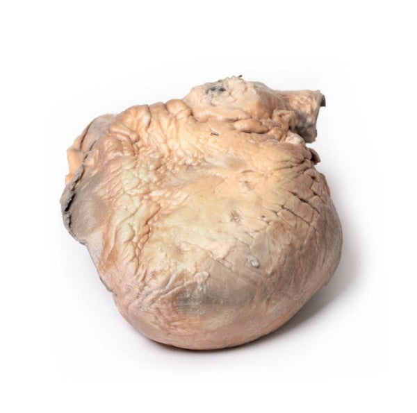 Posterior Aspect of the Ruptured Thoracic Aortic Aneurysm Model