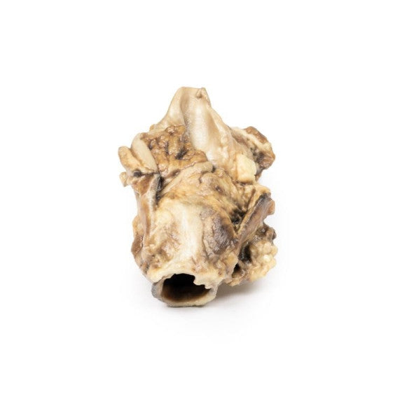 Carcinoma 3D Printed Anatomy Model