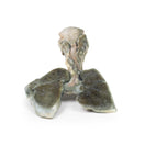 Switch Posterior Aspect of the Tracheoesophageal Fistula and Oesophagus Atresia 3D Printed Anatomy Model 2 image