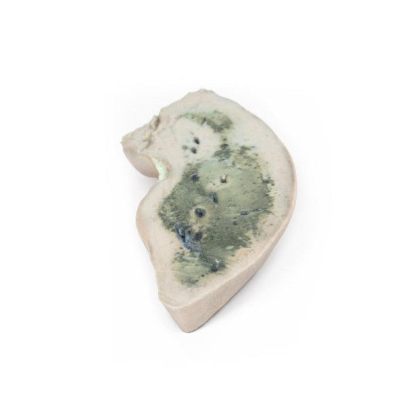 Liver 3D Printed Anatomy Model