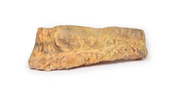 Posterior Aspect of the Ulcerative Colitis 3D Printed Anatomy Model