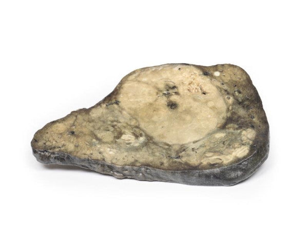 Opposite side of the hepatocellular carcinoma model
