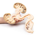 Switch Frontal view of the hydronephrosis hydroureter 3D Printed Anatomy Model 3 image