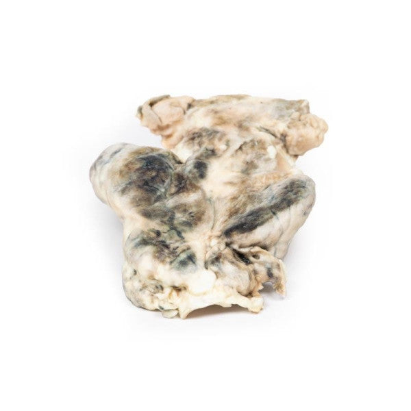 Posterior Aspect of the Multinodular Goitre 3D Printed Anatomy Model