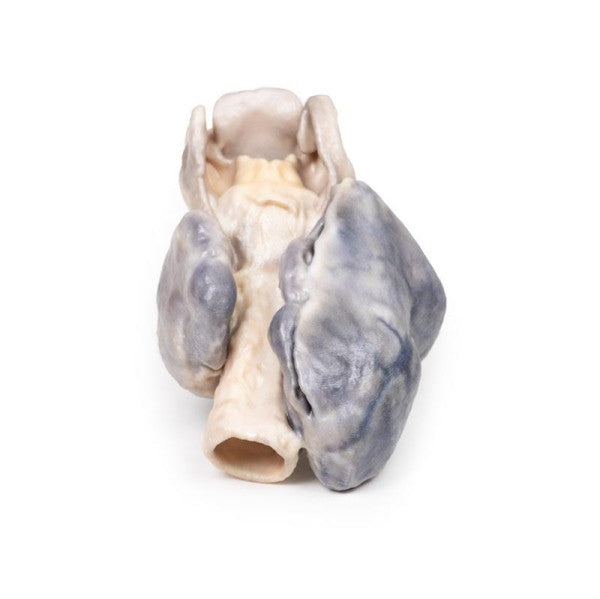 Goitre 3D Printed Anatomy Model