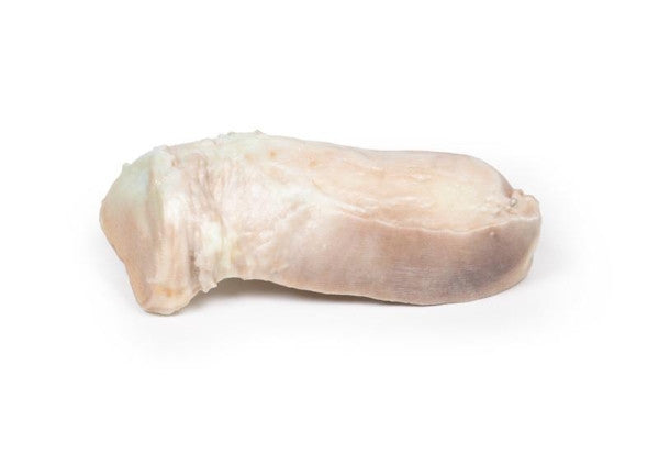 Uterus Pathology 3D Printed Anatomy Model