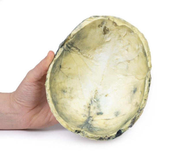 Inferior Aspect of the Tertiary Syphilis 3D Printed Anatomy Model