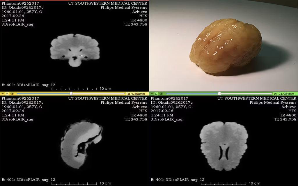 Adult Brain Phantom (Complex) for X-Ray CT, US, MRI
