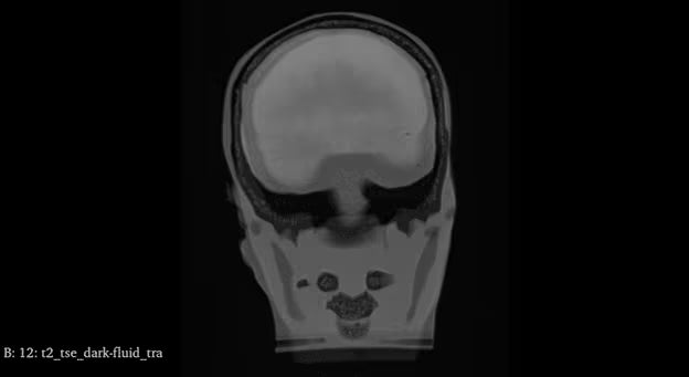 Adult Full Body with Muscles for X-Ray CT, MRI FB-A02 image 35