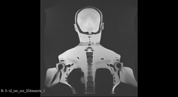 Adult Full Body Phantom with Muscles for X-Ray CT, MRI