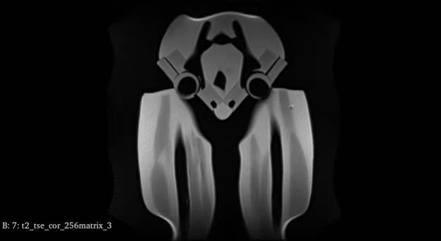 Adult Full Body with Muscles for X-Ray CT, MRI FB-A02 image 38