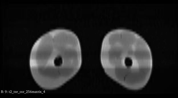 Adult Full Body Phantom with Muscles for X-Ray CT, MRI
