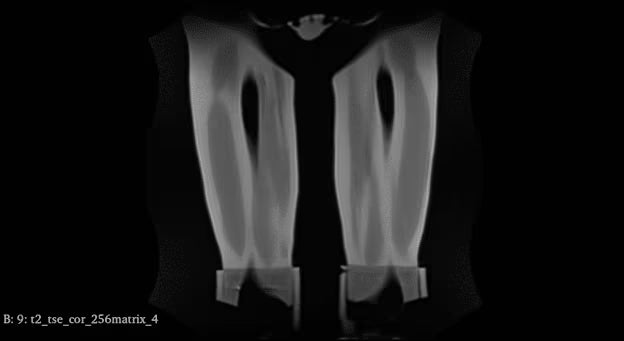 Adult Full Body with Muscles for X-Ray CT, MRI FB-A02 image 40