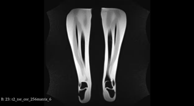 Adult Full Body with Muscles for X-Ray CT, MRI FB-A02 image 41