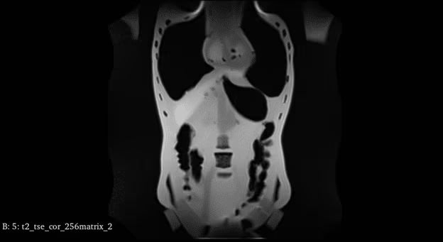 Adult Full Body Phantom with Muscles for X-Ray CT, MRI