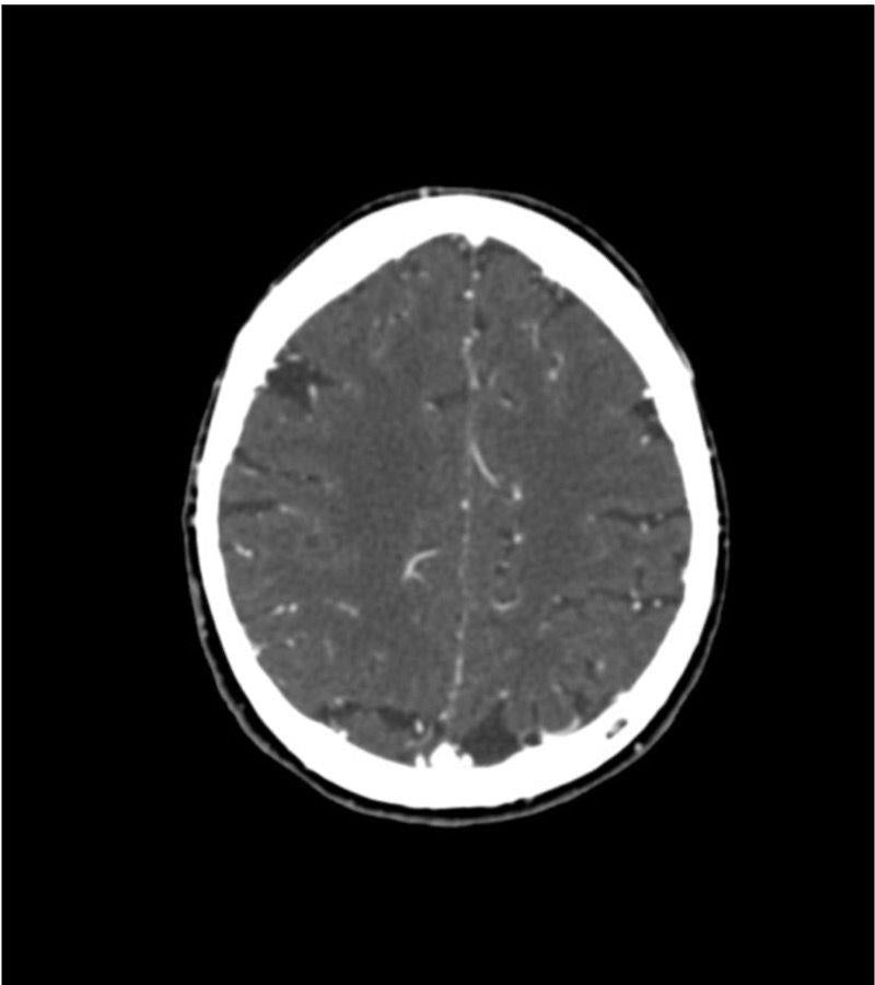 Anatomy Phantom Models for CT,  X-Ray, and Radiation Therapy
