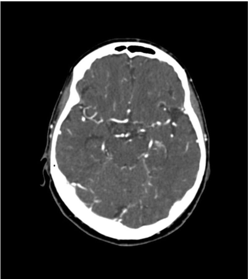 Anatomy Phantom Models for CT,  X-Ray, and Radiation Therapy