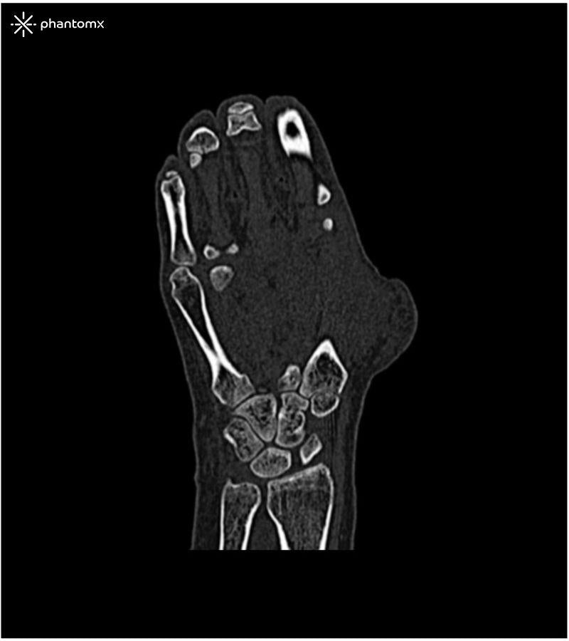 Anatomy Phantom Models for CT,  X-Ray, and Radiation Therapy