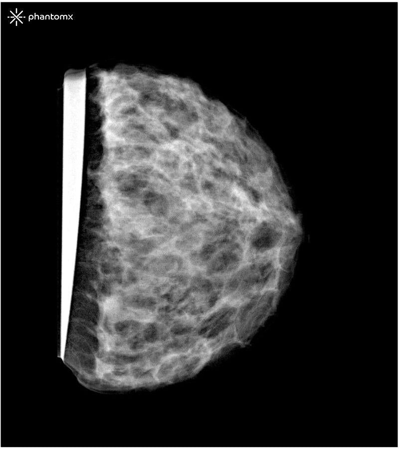 Anatomy Phantom Models for CT,  X-Ray, and Radiation Therapy