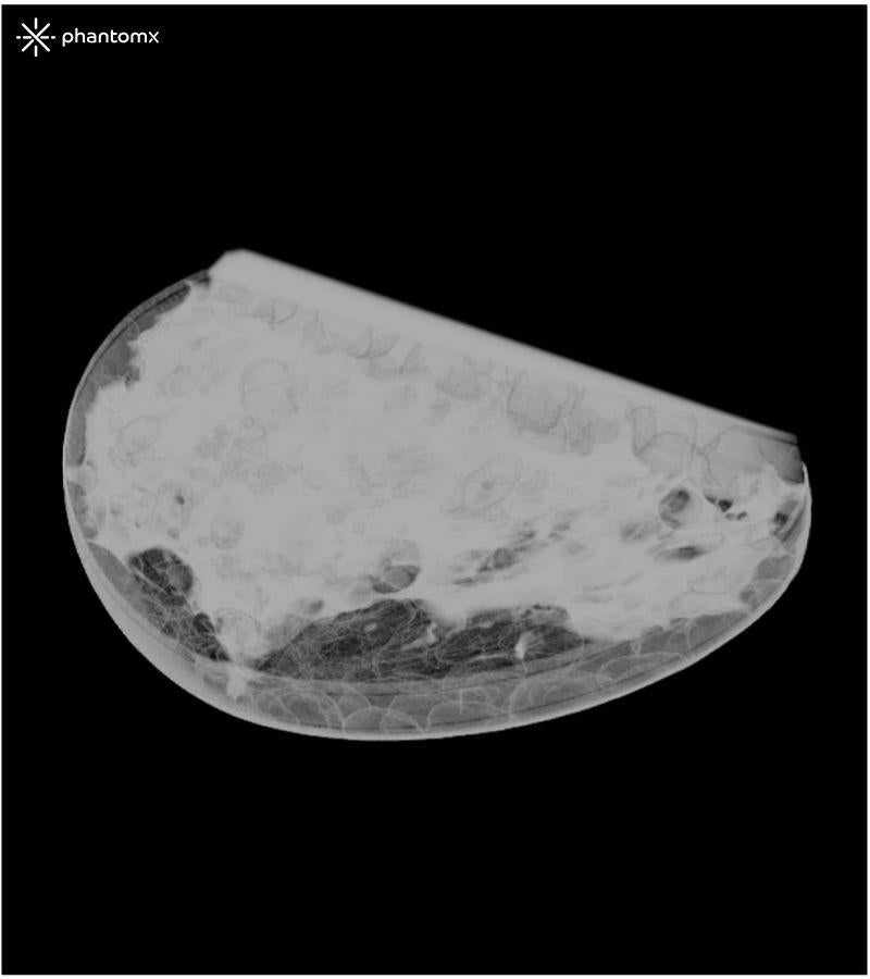 Anatomy Phantom Models for CT,  X-Ray, and Radiation Therapy