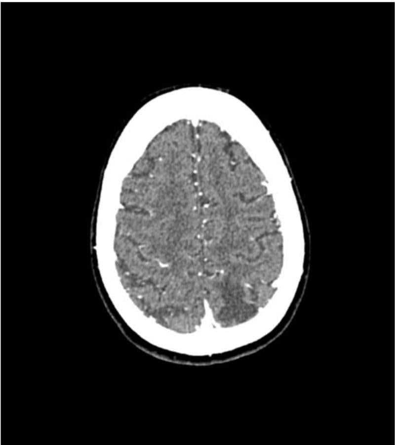Anatomy Phantom Models for CT,  X-Ray, and Radiation Therapy