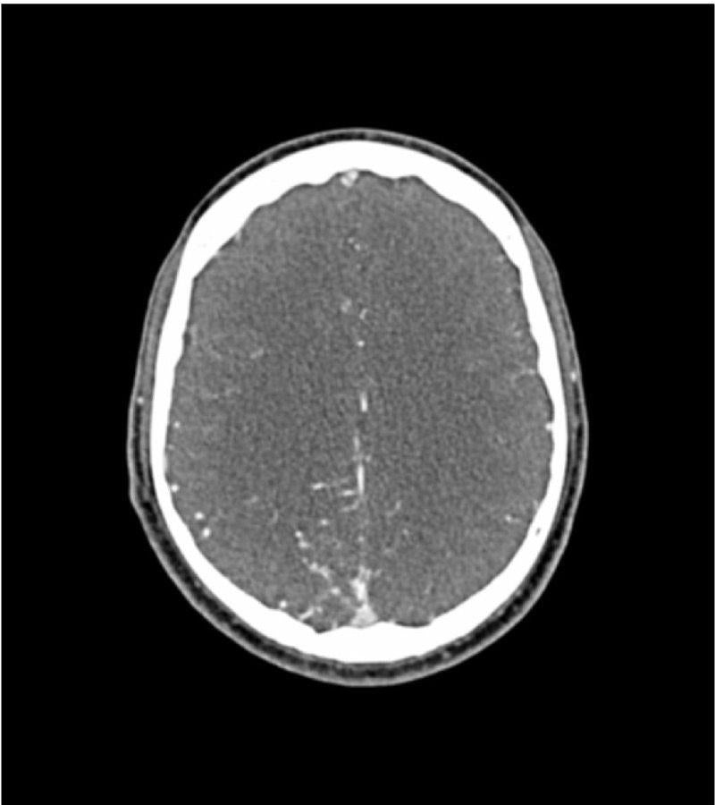 Anatomy Phantom Models for CT,  X-Ray, and Radiation Therapy