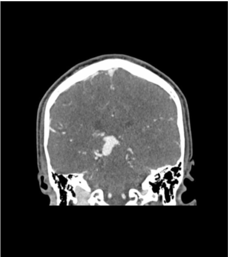 Anatomy Phantom Models for CT,  X-Ray, and Radiation Therapy