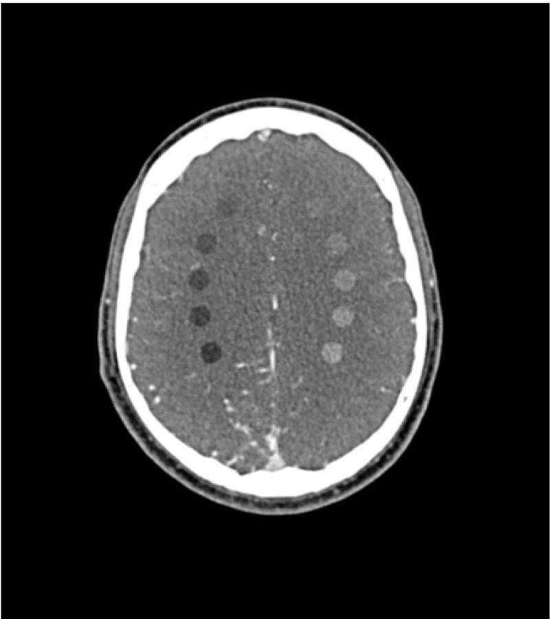 Anatomy Phantom Models for CT,  X-Ray, and Radiation Therapy
