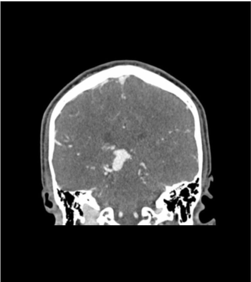 Anatomy Phantom Models for CT,  X-Ray, and Radiation Therapy