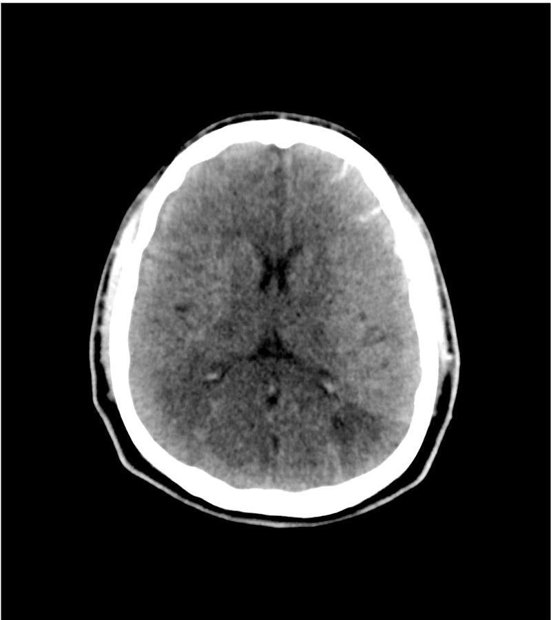 Anatomy Phantom Models for CT,  X-Ray, and Radiation Therapy