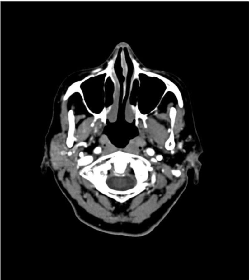 Anatomy Phantom Models for CT,  X-Ray, and Radiation Therapy