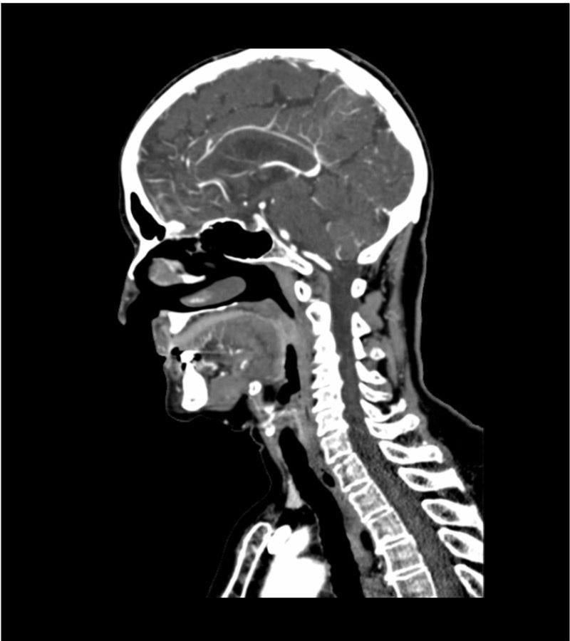 Anatomy Phantom Models for CT,  X-Ray, and Radiation Therapy